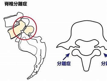症状写真
